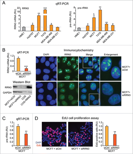 Figure 4. RRN3 knock down in MCF7 breast cancer cells leads to decreased rRNA transcription and inhibition of cell proliferation. (A) RRN3 mRNA level (left) is significantly higher in breast cancer cell lines (yellow) relative to HME1 mammary epithelial cells (gray), and correlates with increased rRNA transcription (assessed as pre-rRNA level) (right). (B) Transient transfection of MCF7 with RRN3 siRNA (10 nM, 48h) decreases RRN3 mRNA (left, top), RRN3 protein (left, bottom), and RRN3 nucleolar accumulation (right) relative to cells transfected with a negative control scrambled sequence (siCtrl). (C-D) RRN3 knock down significantly reduces both rRNA synthesis (assessed by pre-rRNA qRT-PCR) (C) and cell proliferation (assessed by EdU incorporation) (D). * = p < 0.05; ** = p < 0.01; *** p < 0.001.