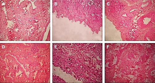 Figure 7 Histopathological condition (magnification 40×) of nasal mucosa after 2 hours exposure to PBS pH 6.4 (negative control) (A), IPA (positive control) (B), Nasacort® (C), NC (D), NE (E), and NLC (F).Abbreviations: IPA, isopropyl alcohol; NC, nanocapsule; NE, nanoemulsion; NLC, nanostructured lipid carrier; PBS, phosphate-buffered saline.