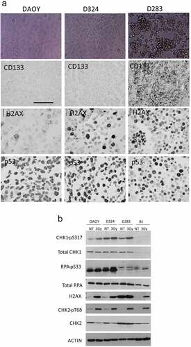 Figure 2. Morphology, selected markers and responses to ionizing radiation in the human medulloblastoma cell lines. (a) Top row: phase contrast microscopy images of exponentially growing DAOY, D324 and D283 cell lines; note the characteristic non-adherent, sphere-like growth pattern of the D283 cells, distinct from the flat morphology of the other cell lines. 2nd–4th row: examples of immunoperoxidase staining patterns for the stem-cell marker CD133, overall endogenous DNA damage (γH2AX) and the p53 tumor suppressor, as indicated, in the three MB cell lines grown under unperturbed conditions; Scale bar: 50 μm; (b) Immunoblot analysis of DNA damage markers in un-irradiated versus irradiated (one hour post 3Gy) MB cell lines and control BJ fibroblasts; note the high level of γH2AX in the D283 cells already before irradiation, and the distinct low RPA ser33 phosphorylation; the less apparent Chk1 and RPA response of BJ cells reflects mainly the lower S-phase dependent protein abundance of Chk1 and RPA, rather than aberrant responses. The DCS270 antibody used to detect total Chk2 levels is known to recognize the activated, T68-phosphorylated Chk2 less efficiently than unphosphorylated Chk2, hence the apparently weaker signals after IR, despite Chk2 levels do not fluctuate throughout the cell cycle [Citation37]