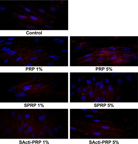 Figure 4 The effect of different concentrations of PRP, SPRP, and SActi-PRP on expression and translocation of FAK in human skin fibroblasts.
