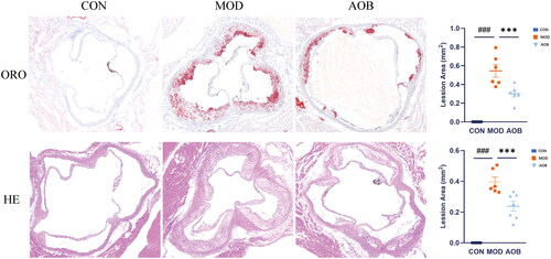 Figure 6. AOB reversed aortic plaque area of AS in APOE−/− mice. HE and ORO stained sections of aortic valve area in the control group, the model group and the AOB group. The atherosclerotic lesion area was quantitatively analyzed by Image J. Data show mean ± SEM values of 6 or more independent samples. # Represents comparison with the control group, ###represents p < 0.001; * represents comparison with the model group, *** represents p < 0.001.