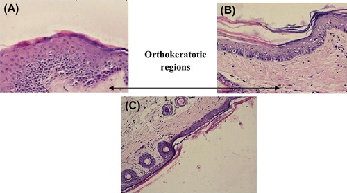 Figure 5. Photographs of Skin treated with (A) MXT (400 ×), (B) Trioxysalen (400 ×), and (C) MXT and trioxysalen (400 ×).