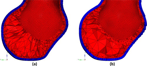Figure 2. Example of finite element meshes generated in this study (Patient 3). Blue color: aneurysm wall (with a constant wall thickness of 1.5 mm). Red color: intraluminal thrombus (ILT) meshed using tetrahedral elements. (a) Tetrahedral meshes of aneurysm wall, and (b) hexahedral meshes of aneurysm wall. Both meshes have two layers of elements through the wall thickness.