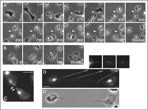 Figure 2 Cytokinesis defects as a result of DdCenB knock-out. (A) consists of images captured from time-lapse microscopy. The time of capture (minutes) for each frame is indicated in the lower right corners. The arrowheads point to the persistent cytoplasmic bridges observed in dividing cells. In (B) we see a wild-type cell dividing. Here the arrowhead points to a typical cleavage furrow. (C) is a dividing mutant cell stained with DA PI (DNA) and visualized by fluorescence/DIC microscopy. Arrows point to distorted nuclei in the furrow region. (D) shows a mutant cell, with a long cytoplasmic bridge, stained with DAPI. The arrows point to higher magnifications of the respective areas, and highlight the presence of DNA in the cytoplasmic bridge. D, fluorescence; D’, phase contrast. Bars in all cases correspond to 5 µm.