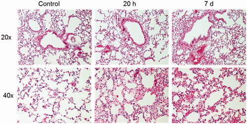 Figure 7. Histopathological evaluation of lung sections from mice exposed to an ammonia dose of 91.0 mg/kg·bw at two different time-points after exposure, 20 h and 7 days, and healthy controls. Photographs show representative bronchial (upper panels) and alveolar areas (lower panels) of the lungs at each time. Sections stained with hematoxylin and eosin and evaluated using light microscopy using 20 and 40x magnification.