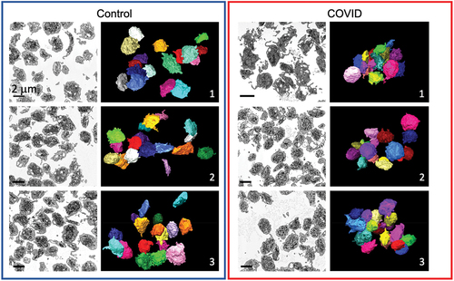 Figure 1. FIB-SEM raw images and 3D surface rendered models of platelets from Control and COVID-19 patients. x-y orthoslices and 3D surface renderings of 17 platelets from each of 3 Control and 3 COVID-19 patients are shown. Scale bars (2 µm) as shown.