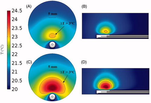 Figure 4. Temperature maps derived from simulations in agar phantom after 5 min heating with an input power of 8 W (A) in axial view and (B) sagittal view; and input power 12 W (C) in axial view and (D) sagittal view.