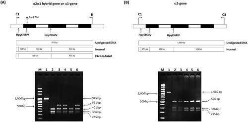 Figure 6. Identification of AAC>AAA mutation by HpyCH4IV digestion of the PCR product. (A) HpyCH4IV digestion of the in cis α2α1 hybrid and α1 genes. Lane 1 is the undigested amplified DNA (975 bp). lanes 2 and 5 are HpyCH4IV-digested amplified DNA of the proband’s mother and wife, who had normal α-globin allele (αα/αα). the 561-bp digested fragment in lanes 3, 4, and 6 indicates the presence of Hb Doi-Saket mutation in the proband, his father, and son. (B) HpyCH4IV digestion of the α2 gene. Three fragments of 506, 306, and 255 bp were produced, whereas the 561-bp fragment was not produced owing to the absence of AAC>AAA mutation.