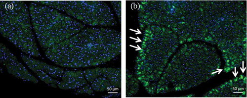 Figure 2. HIS protein detection in pancreas by immunohistochemistry: (a) phosphate-buffered saline control; (b) full construct with miR-199a-3p (Full with 199) extracellular vesicle (EV) treatment group. HIS protein was expressed and detected in the Full with 199 EVs (arrows).