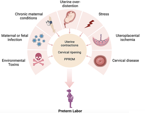 Figure 3 Proposed mechanisms of disease implicated in spontaneous preterm labor. Created with BioRender.com.