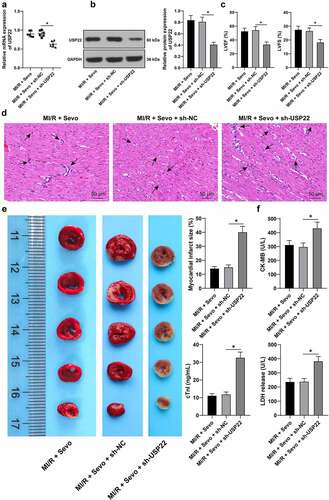 Figure 2. USP22 ablation reverses the protective effect of SPC on MI/RI rats. MI/RI rats subjected to SPC were injected with LV-sh-USP22, with sh-NC injection as control. A and B, USP22 expression in rat myocardium was determined by qRT-PCR (a) and western blot analysis (b), N = 6. C, LVEF% and LVFS% were tested by ultrasonic cardiogram, N = 18. D, pathological injury in rat myocardium was detected by H&E staining (black arrows indicate inflammatory cell infiltration), N = 6. E, rat myocardial infarction area was measured by TTC staining, N = 6. F, CK-MB, cTnI, and LDH levels in rat serum were evaluated, N = 18. The data were presented as mean ± standard deviation. One-way ANOVA was used to analyze the data in panels A-F. Tukey’s multiple comparisons test was applied for the post hoc test. * p < 0.05.