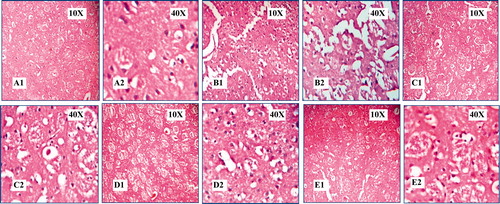 Figure 2. Effect of methanol extract of Stereospermum suaveolens in global cerebral ischemia/reperfusion-induced oxidative stress in rat. Photograph of brain section from different treatment groups stained with hematoxylin and eosin. Plates – A1 and A2: Sham group (normal saline 10 ml/kg), B1 and B2: Control (normal saline 10 ml/kg + ischemia 30 min followed by 4 h reperfusion), C1 and C2: MES 125 mg/kg + ischemia 30 min followed by 4 h reperfusion, D1 and D2: MES 250 mg/kg + ischemia 30 min followed by 4 h reperfusion, E1 and E2: MES 500 mg/kg + ischemia 30 min followed by 4 h reperfusion. In B1 and B2, there was marked infiltration of neutrophils, intracellular space increased and density of the cells decreased, architecture completely altered, and also haemorrhage and neuronal cell death was observed. There is significant protection from damage observed in the MES-treated groups (C1-E2), and protection observed in treated groups was comparable with the sham group (A1 and A2). MES = methanol extract of Stereospermum suaveolens.