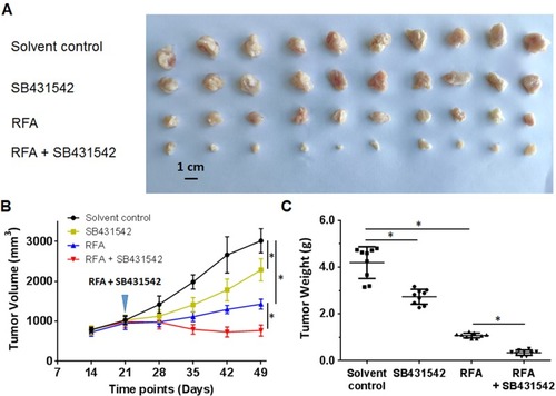 Figure 4 The effects of a combination of SB431542 and RFA on subcutaneous growth of BC cells. A patient-derived BC cell line (patient no. 1) was injected into nude mice to form subcutaneous tumors. RFA of the tumor tissues was performed, and the mice were treated with SB431542 at a dose of 1 mg/kg via oral administration. The results are shown as photographs (A) of subcutaneous tumors, tumor-growth curves (B) or tumor weights (C) at the end of the experiment. *P<0.05.Abbreviations: BC, bladder cancer; RFA, radiofrequency ablation.