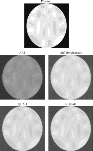 Figure 5. Case 2: phantom and reconstructed images at 10 iterations.