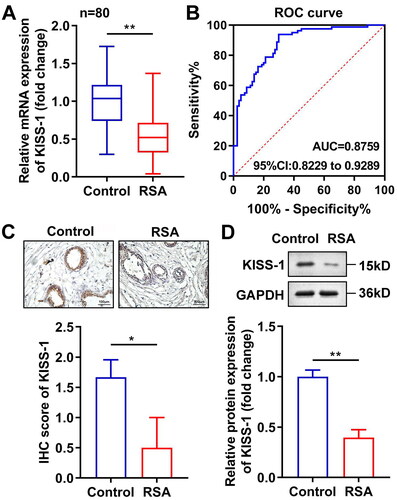 Figure 1. KISS-1 was down-regulated in RSA. The KISS-1 levels in the villus tissue of the RSA patients were assessed via RT-qPCR (a), immunohistochemistry (C) and western blotting (D) assays. (B) ROC curves of KISS-1 in RSA. **p < 0.01.