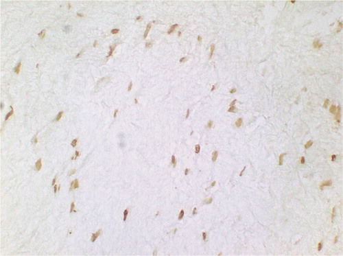 Figure 9. Figure 9. TUNEL-positive cells at 3 weeks after RF treatment without immobilization: the staining of apoptotic nuclei is more intense than in permanently immobilized tendon (original magnification: × 750).