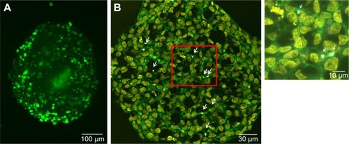 Figure 3 Morphology of HepG2 spheroids.Notes: (A) Formation of bile canaliculi in HepG2 spheroids. Spheroids were stained for bile canaliculi at day 7 after cell seeding and analyzed by lightsheet microscopy. A maximum intensity projection was generated from a z-stack of representative spheroid. (B) CLS images of HepG2 spheroids. For imaging, spheroids were fixed, cut into 10-µm-thick cryoslices and stained for nucleus (yellow), actin cytoskeleton (green), and MRP-2 (gray), which is expressed in the canalicular membrane. One representative image of spheroid is shown. Red box indicates the detailed image position. A detailed image is shown on the right. Arrows indicate the localization of MRP2 (gray) in the micrograph.Abbreviations: CLS, confocal laser scanning microscopy; MRP-2, multidrug resistance-associated protein2.