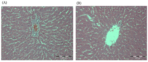 Figure 7. Photomicrographs from the liver of (A) control and (B) treated rats at dose 5000 mg/kg. There were no adverse histopathological conditions observed in the liver of the control and treatment groups. The liver for the treatment group appeared normal with preserved hepatic architecture. The was no sign of inflammation in the treated group.