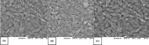 Figure 2. SEM image. The figure “A” is an immediate image, the “B” is after labeling with 99mTc and “C” is 1 month after labeling with 99mTc.
