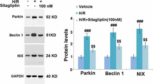 Figure 5. Sitagliptin prevented mitophagy in H/R-challenged H9c2 cardiomyocytes. Cells were exposed to H/R in the presence or absence of Sitagliptin (100 nM) for 6 h. The expressions of mitophagy markers Parkin, Beclin 1, and NIX (###, P < 0.001 vs. vehicle group; $$, P < 0.01 vs. H/R group, mean ± S.D., N = 5).