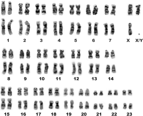 Figure 3. G-banded karyotypes of E. quercinus from Central Italy (upper row, female) and Sicily (lower row, male).