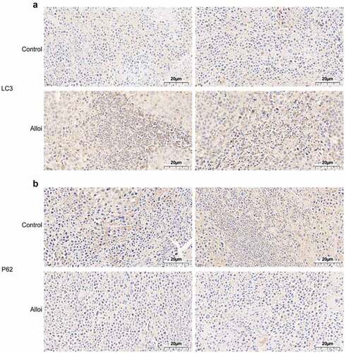 Figure 8. The expression of autophagy proteins LC3 and p62 in tumor tissues was monitored by immunohistochemistry. (a, b) LC3 staining was darker and p62 staining was lighter in the tumor tissue of the Alloi intervention group than in the control group; 40×x microscope.