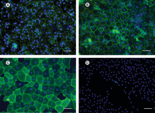 Figure 2. Immunocytochemistry using different biomarkers.Human corneal endothelial cells were stained in green for (A) ZO-1, (B) 1A3, (C) 2A12 and (D) Ki-67. Nuclei were counterstained in blue. Hexagonal shape of corneal endothelial cells was clearly observed after stained with cell surface marker antibodies. Cell proliferation marker, Ki-67, was used to evaluate number of cells which have proliferative capacity.Scale bar = 100 μm.