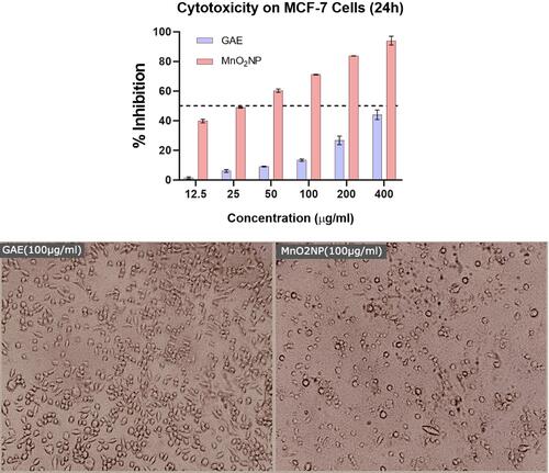 Figure 5 Cytotoxicity of as-prepared MnO2 NPs against MCF-7 cells (top). Photomicrographs of MCF-7 cells treated with GAE (100 μg/mL) and MnO2 NPs (100 μg/mL).