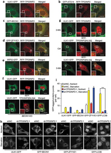 Figure 2. Association of TP53INP2 with early autophagic structures. (a-e) Colocalization of RFP-TP53INP2 with ULK1-GFP (a), GFP-ATG14 (b), GFP-BECN1 (c), GFP-ZFYVE1 (d) or WIPI2-GFP (e) in starved MEFs. (f and g) Localization of RFP-TP53INP2 or RFP-TP53INP2[NLSΔ] in starved BECN1-KO (f) or 3-MA-treated (g) HEK293 cells. The cells were imaged by confocal microscope 24 h after cotransfection of the plasmids. (h) Formation of puncta in HEK293 cells stably expressing ULK1-GFP, GFP-BECN1, GFP-ZFYVE1 or GFP-LC3B. The cells were infected with lentivirus expressing non-silencing control shRNA or TP53INP2 shRNA for 72 h, with or without cell starvation for 2 h. (I) Quantification of the puncta in (h). The data are presented as mean ± SEM, n = 30 cells. ***, P < 0.001. Scale bars: 10 µm.