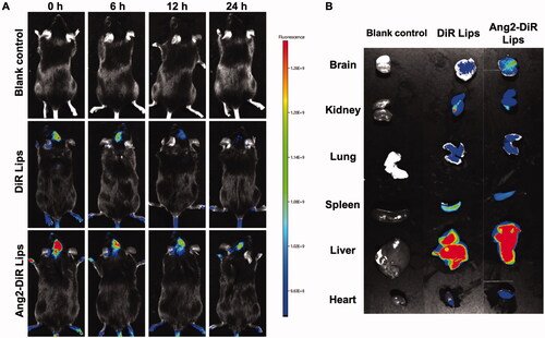 Figure 4. Real-time imaging observation after intravenous administration of varying liposomal formulations in APP/PS-1 mice. (A) Real-time images in vivo; (B) ex vivo optical images of brain, heart, liver, spleen, lung, and kidney tissues at 24 h (n = 3).