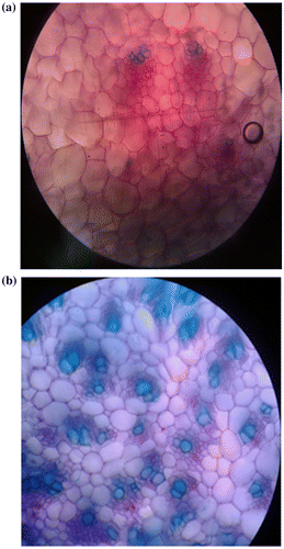 Figure 2. Cross section of the shoot of (a) regenerated plantlet from somatic embryo; (b) mother plant (×10).