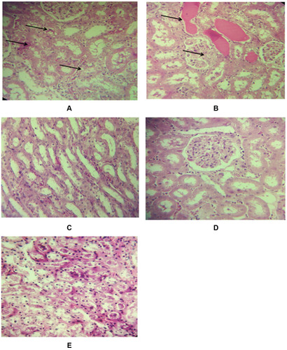 Figure 2 Sections of renal tissue from different groups: (A) control, (B) saline, (C) exercise, (D) garlic, and (E) exercise + garlic groups. Black arrows: mild necrosis, intratubular hemorrhage and sloughing of epithelium.