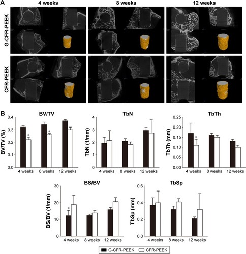 Figure 8 (A) 3D reconstruction of the G-CFR-PEEK scaffolds and CFR-PEEK scaffolds after 4, 8, and 12 weeks of being implanted. The yellow component indicates newly formed bone around the scaffolds (white) (n=3). (B) Microstructural parameters were analyzed from the fluorescence images of A. Results presented as means ± SD. *P<0.05.Abbreviations: BS, bone surface; BV, bone volume; CFR-PEEK, carbon fiber-reinforced polyether ether ketone; G-CFR-PEEK, graphene-modified carbon fiber-reinforced polyether ether ketone; TbN, trabecular number; TbSp, trabecular spacing; TbTh, trabecular thickness; TV, total volume.