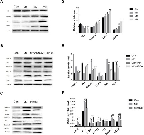 Figure 4 Melatonin increased speed of AGS cell apoptosis and autophagy by ER stress-upregulation. (A) Western blot analysis of the ER stress associated with protein expressions. Following the melatonin treatment, the GRP78 expressions significantly upregulated compared with the control group in a dose-dependent manner. β-actin was utilized for normalization of band density as the loading control. (B) Western blot analysis of ER stress and autophagy related proteins expression following treating with the ER stress inhibitor 4- PBA and autophagy inhibitor 3-MA. (C) Western blot analysis of protein expression following treating with the IRE inhibitor STF 083010. It was found that GRP78, P62, Beclin-1, p-JNK, and LC3II expression was significantly upregulated in comparison with the control group, and, since 2mM melatonin is given, the protein expression was inverted. (D–F) Western blot results were measured and provided as the percent of the control. All tests were performed three times. Here, data are presented as the means ± SD, n=3. Student’s t-test was compared to control. *P<0.05, **P<0.01 compared to the control.Abbreviations: GRP78, glucose-regulated protein 78; 4-PBA, 4-phenylbutyric acid; 3-MA, 3-Methyladenine; STF, STF-083010; M2, 2 mM melatonin; JNK, c-Jun N-terminal kinase; p-, phosphorylated; Con, control trip.