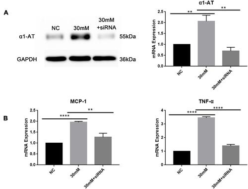 Figure 4 Effects of α1-AT siRNA transfection on HK-2 cells under high glucose stimulation. (A) Western blot and qRT-PCR analysis for transfection efficiency of α1-AT siRNA in HK-2 cells stimulating with high glucose. (B) Differential expression of MCP-1 and TNF-α mRNA levels in HK-2 cells treating with α1-AT siRNA transfection under high glucose stimulation measured by qRT-PCR. NC: normal glucose (5.5mM) with Negative Control siRNA; 30mM: high glucose (30mM) with Negative Control siRNA; 30mM+siRNA: high glucose (30mM) with α1-AT siRNA. **P<0.01, ****P<0.0001.