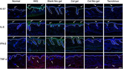 Figure 6 Expression of Ki-67, IL-6, IFN-β, and TNF-α of skin lesions after the treatment of IMQ and other formulations (n=6). Blue, DAPI; Green, Alexa Fluor 488; Red, Alexa Fluor 647. The dotted line demonstrates the border between the epidermis and dermis. Arrows label the representative positive location. Scale bar: 100 μm.