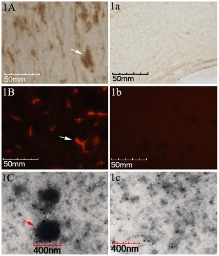 Figure 1 Identification of CNPs in paraffin-embedded pulp stone sections. A) The brown colored areas indicated by black arrows, by point indicate positive signals (existence of CNPs antigen) in the tissues by IHS. a) Negative control by IHS. B) Positive signals can be identified as red fluorescence by, IIFS. b) Negative control by IIFS. C) A TEM image at 35,000× zoom-in level shows the CNPs as spherical particles surrounded by a compact crust, 200–400 nm in diameter. c) Negative control in TEM image.