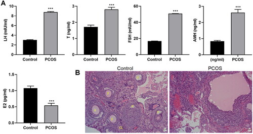 Figure 1. Establishment of polycystic ovary syndrome mouse model. A mouse model of PCOS was constructed with DHEA. (A) Serum levels of LH, T, FSH, AMH, and E2 were examined with ELISA. (B) Pathological changes of mice ovarian tissues were estimated using hematoxylin–eosin (HE) staining (×200). The follicles (F) and corpus luteum (CL) are shown on the control group ovarian micrographs. ***p < .001 vs. control.