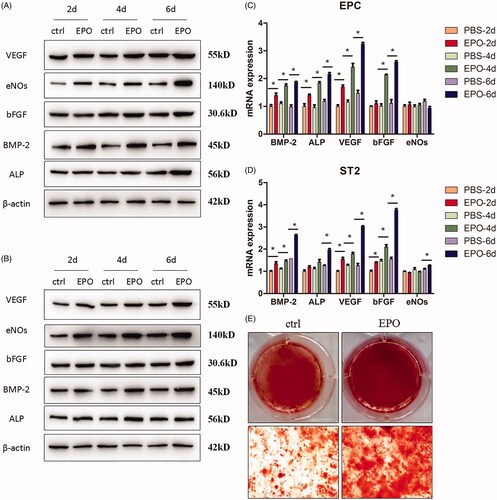 Figure 2. Effects of EPO on cell differentiation. (A) The Western blot results of angiogenesis key molecules like VEGF, eNOs, bFGF, and osteogenic markers like BMP-2 and ALP expressed by EPC applying EPO. (B) The Western blot results of key molecules expressed by ST2. (C) The mRNA level of key molecules expressed by EPC. (D) The mRNA level of key molecules expressed by ST2. (E) The staining results of alizarin red to evaluate the mineralisation nodes of ST2 applying EPO. “*” means p < .05.