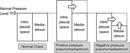 Figure 3 The balance between the pressures in the intrathoracic cavity and the mediastinum in a normal chest. When the intrapleural space pressure rises, a positive pressure pneumomediastinum develops to balance the difference. Similarly, negative pressure pneumomediastinum occurs to abolish the pressure difference when the mediastinal pressure decreases.