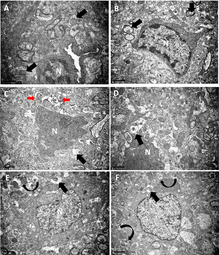 Figure 3 Electron micrographs of cerebral cortex of control (A) and LS-treated (B) rats show intact neurons with open-face nuclei and prominent nuclei (N). Many glial cells (thick arrows) with small dense nuclei appeared, surrounding these neurons (transmission electron microscopy). Cerebral cortex of AD (C and D) show small, shrunken, and deformed neural and glial cells (thick arrows) with dark, deformed, irregular nuclei (N) and some autophagosomes (red arrows). LS-treated AD (E and F) rats show most neurons intact with open-face and prominent nucleiN. Many glial cells (thin arrows) appear intact, apart from a few degenerated cells (thick arrows) that show dark vacuolated cytoplasm and deeply stained nuclei (transmission electron microscopy).
