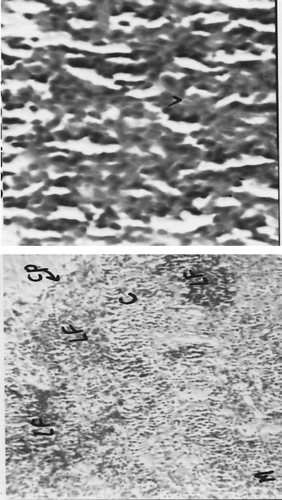 FIG. 4B Representative photomicrograph of axillary lymph node tissues recovered from rats on Day 22 of the respective indicated treatment regimens (C = Cortex, CP = Capsule, M = Medulla, and LF = Lymphoid follicles)—n-Butanol extract-treated rats. Left image at 10×, Right image at 40×.