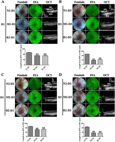 Figure 2. RSV-induced effect on living ocular structure of MNU-administrated rats. A, B: Typical images of fundus photograph, FFA, OCT of rats with RSV intervention of the first mode, and plot of length from junction of OPL and ONL to RPE at 1 d (A) and 3 d (B) after MNU administration; C, D: Typical images of fundus photograph, FFA, OCT of rats with RSV intervention of the second mode, and plot of length from junction of OPL and ONL to RPE at 1 d (A) and 3 d (B) after MNU administration. (n = 3; MI: the middle area of the retina; MP: the mid-peripheral area of the retina; P: the peripheral area of the retina; **P < 0.01: vs. N group).