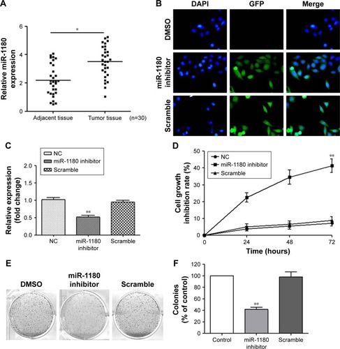 Figure 1 MiR-1180 is upregulated in WT, and the inhibition of miR-1180 suppressed WT cell proliferation.