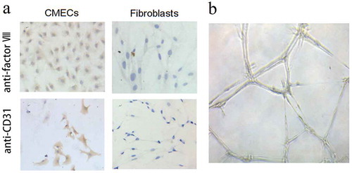 Figure 1. Characterization of cardiac microvascular endothelial cells (CMECs). (a) The characterization of CMECs was performed by immunocytochemistry, showing that CMECs factor VIII and CD31 had more than 95% of positive staining rates. Cardiac fibroblasts were used as control, in which the fibroblasts were stained as negative since these two markers (factor VIII and CD31) are endothelium-specific. (b) In vitro tubule formation assay showed that CMECs grew into a three-dimensional network of irregular tubular structure on Matrigel. All the images were taken at 100× magnification.