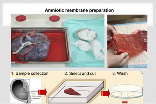 Figure 1 Preparation of amniotic membrane pieces.