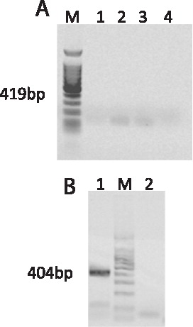 FIGURE 1  Bisulfite primer design impacts PCR amplification. (A) IGF2 PCR products using previously published primers and conditions (bisulfite-10.1 and 10.2 F and R primer pairs; [Gebert et al. Citation2006]); Lane 1–2: 1,000 cells, Lane 3: IVP blastocyst-stage embryo, Lane 4: no template control ; Expected product size should have been 419 bp; (B) IGF2 PCR product from primers designed using 3 step method; Lane 1: IVP blastocyst-stage embryo; Lane 2: no template control. M: 100 bp ladder; Expected product size was obtained, 404 bp.