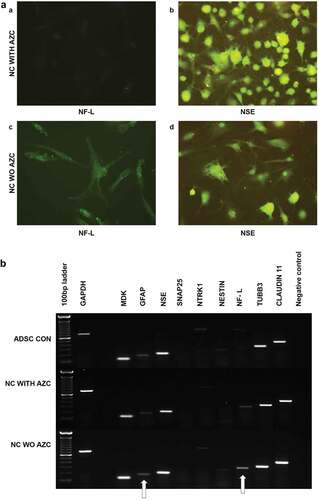 Figure 8. Immunocytochemical analysis of ADSCs on d 30 after induction (a), with β-ME, NIM, and AZC showed NSE positivity and NF-L negative. The resultant cells are spheroids with minute neurite projections, resembling poorly differentiated structures (a, b). ADSCs on d 30 after induction with β-ME and NIM without AZC showed NSE and NF-L positivity. They resultant cells are not spheroids (c, d) (Magnification 20 x). Semi-quantitative gene expression profiling by RT-PCR of ADSC-derived neural-lineage cells at d 30 after induction (b). Neural – lineage cells obtained through the treatment of NIM without 5-azacytidine (NC WO AZC) and Neural – lineage cells obtained through the treatment of NIM with 5-azacytidine (NC with AZC). Untreated ADSCs used as control. The analysis shows reduced expression of neurofilaments.