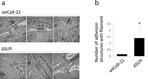 Figure 3. (a) Typical TEM images of wtCa9-22 and ΔSLPI cells in a cluster. Well-developed filaments elongating from the desmosome junction are observed in the cytoplasm of ΔSLPI cells in the cluster. N: nucleus; M: mitochondria; Ph: phagosome; arrowhead (white): cytoplasmic filament bundle; arrowhead (black): desmosome junction. Scale bar: 0.5 µm. (b) Quantification of the number of desmosome junctions with filament bundles. The number of desmosome junctions with filament bundles was determined in 20 sets of cell-cell adhesion structures in wtCa9-22 and ΔSLPI cell clusters, respectively, and the average mean ± standard deviation was determined (n = 20, *P < 0.05 vs. wtCa9-22).