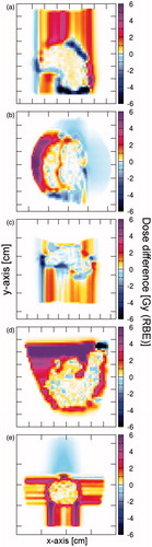 Figure 4. Dose difference maps of a representative patient for all indications: (a) Neuroblastoma, (b) Wilms tumor, (c) Hodgkin lymphoma, (d) Ewing sarcoma, (e) Ependymoma. The red shaded areas represent the voxel receiving more dose in the proton plans, the blue shaded ones receiving more dose in the 4He plan. Color figure available online.